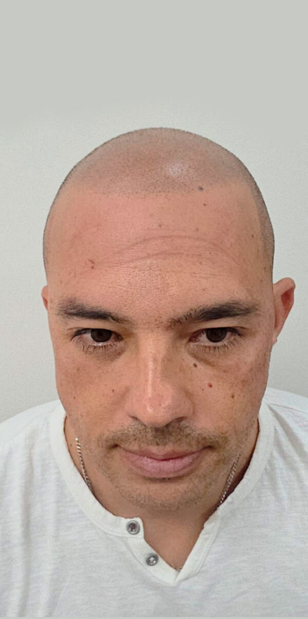 DESPUÉS
